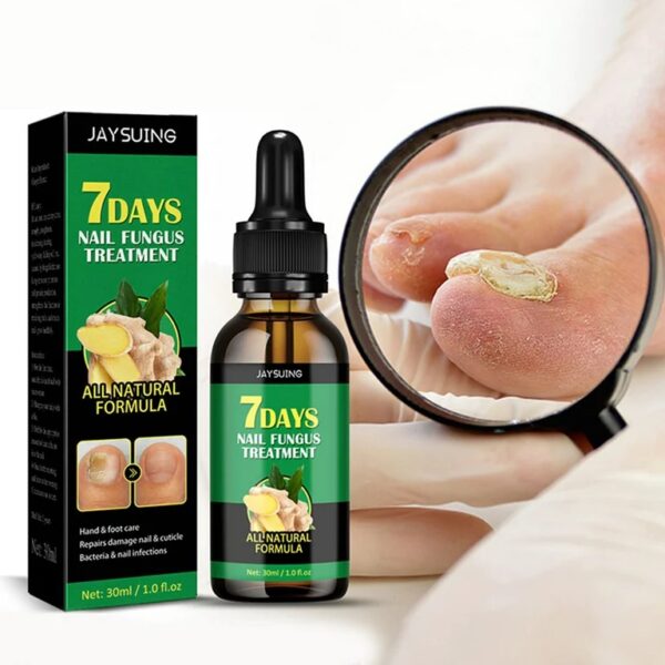 7 Days Ginger Nail Fungal Treatment Feet Care Essence - Image 4